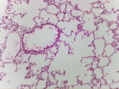 Lung tissue